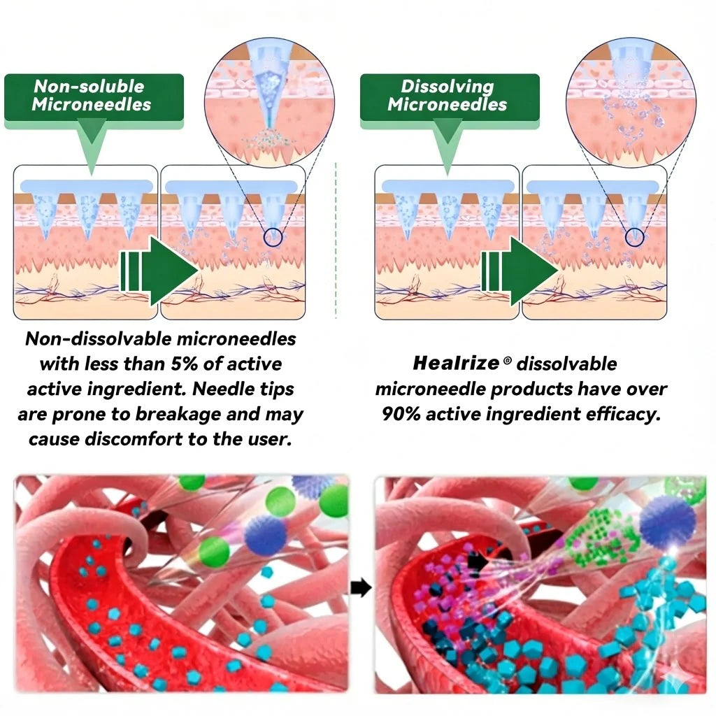 ✅𝗢𝗳𝗳𝗶𝗰𝗶𝗮𝗹 𝗦𝘁𝗼𝗿𝗲 | Healrize® 𝙈𝒐𝒓𝒊𝒏𝒈𝗮 · 𝗕𝗲𝗿𝗯𝐞𝐫𝐢𝐧𝙚 × 𝙉𝑨𝑫+ 𝟏𝟎-𝙞𝙣-1 𝘼𝒅𝒗𝒂𝒏𝒄𝒆𝐝 𝐍𝐚𝐧𝙤 𝙈𝙞𝙘𝙧𝙤𝙣𝒆𝒆𝒅𝒍𝐞 𝐏𝐚𝐭𝙘𝙝(𝗝𝘂𝘀𝘁 𝗼𝗻𝗰𝗲 𝗮 𝗱𝗮𝘆, 𝘃𝗶𝘀𝗶𝗯𝗹𝗲 𝗿𝗲𝘀𝘂𝗹𝘁𝘀 𝗶𝗻 𝟳 𝗱𝗮𝘆𝘀) (offer)