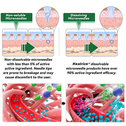✅𝗢𝗳𝗳𝗶𝗰𝗶𝗮𝗹 𝗦𝘁𝗼𝗿𝗲 | Healrize® 𝙈𝒐𝒓𝒊𝒏𝒈𝗮 · 𝗕𝗲𝗿𝗯𝐞𝐫𝐢𝐧𝙚 × 𝙉𝑨𝑫+ 𝟏𝟎-𝙞𝙣-1 𝘼𝒅𝒗𝒂𝒏𝒄𝒆𝐝 𝐍𝐚𝐧𝙤 𝙈𝙞𝙘𝙧𝙤𝙣𝒆𝒆𝒅𝒍𝐞 𝐏𝐚𝐭𝙘𝙝(𝗝𝘂𝘀𝘁 𝗼𝗻𝗰𝗲 𝗮 𝗱𝗮𝘆, 𝘃𝗶𝘀𝗶𝗯𝗹𝗲 𝗿𝗲𝘀𝘂𝗹𝘁𝘀 𝗶𝗻 𝟳 𝗱𝗮𝘆𝘀) (offer)