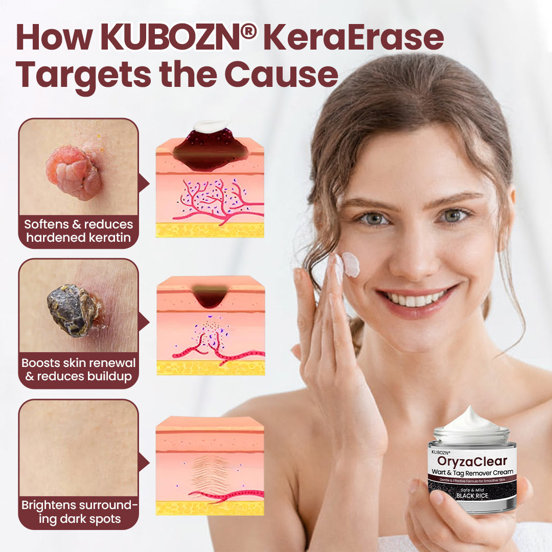⭐ KUBOZN® OryzaClear – Black Rice Power Cream for Skin Tags & Bumps · Gentle Plant-Based Softening Formula