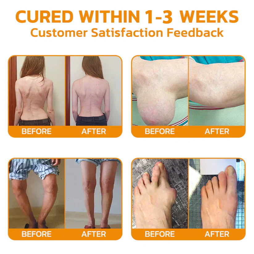 CA🏅  KUBOZN® MagniVen Magnesium & Bee Venom Joint Spray – 5 Min Relief · 7 Day Mobility · 4 Week Comfort