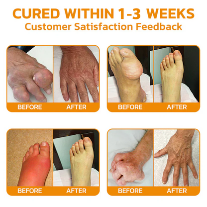 CA🏅  KUBOZN® MagniVen Magnesium & Bee Venom Joint Spray – 5 Min Relief · 7 Day Mobility · 4 Week Comfort