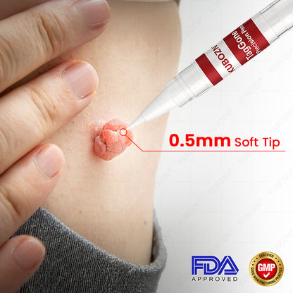 ✨KUBOZN® TagGone Precision Pen (2025 Upgrade) | Skin Tag, Mole & Wart Remover – Fast, Gentle & Scar-Free in 5 Days (offer)