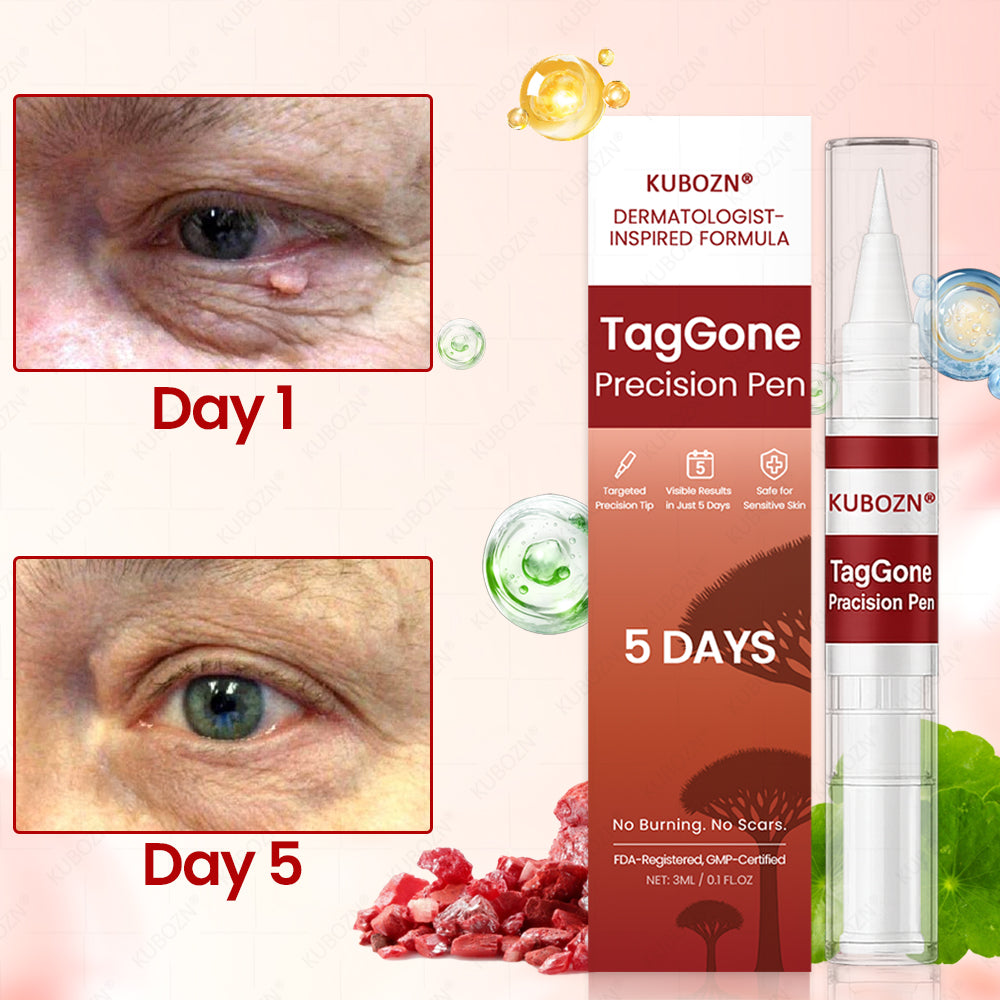 ✨KUBOZN® TagGone Precision Pen (2025 Upgrade) | Skin Tag, Mole & Wart Remover – Fast, Gentle & Scar-Free in 5 Days (offer)