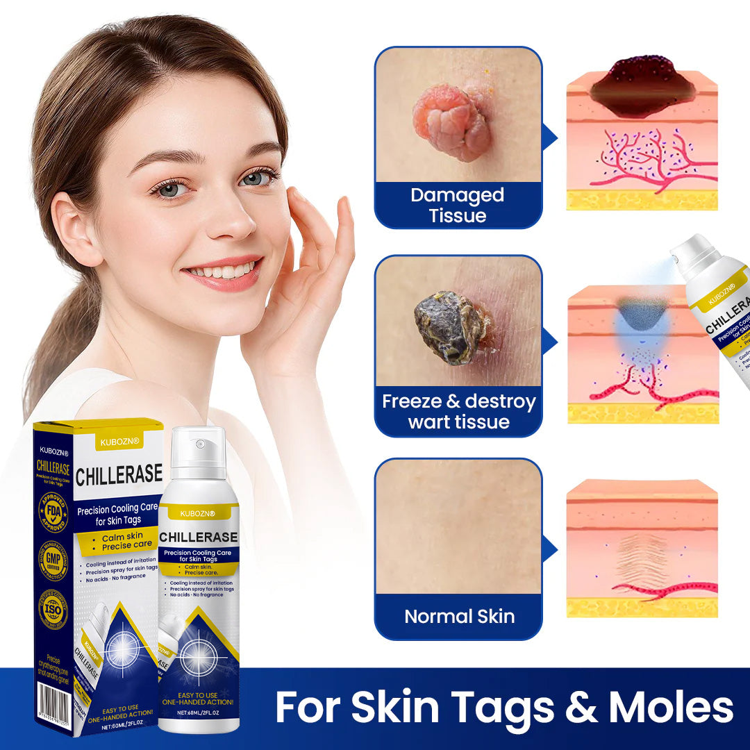 ⚡KUBOZN® ChillErase Cooling Spray for Skin Tags