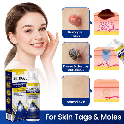 ⚡KUBOZN® ChillErase Cooling Spray for Skin Tags