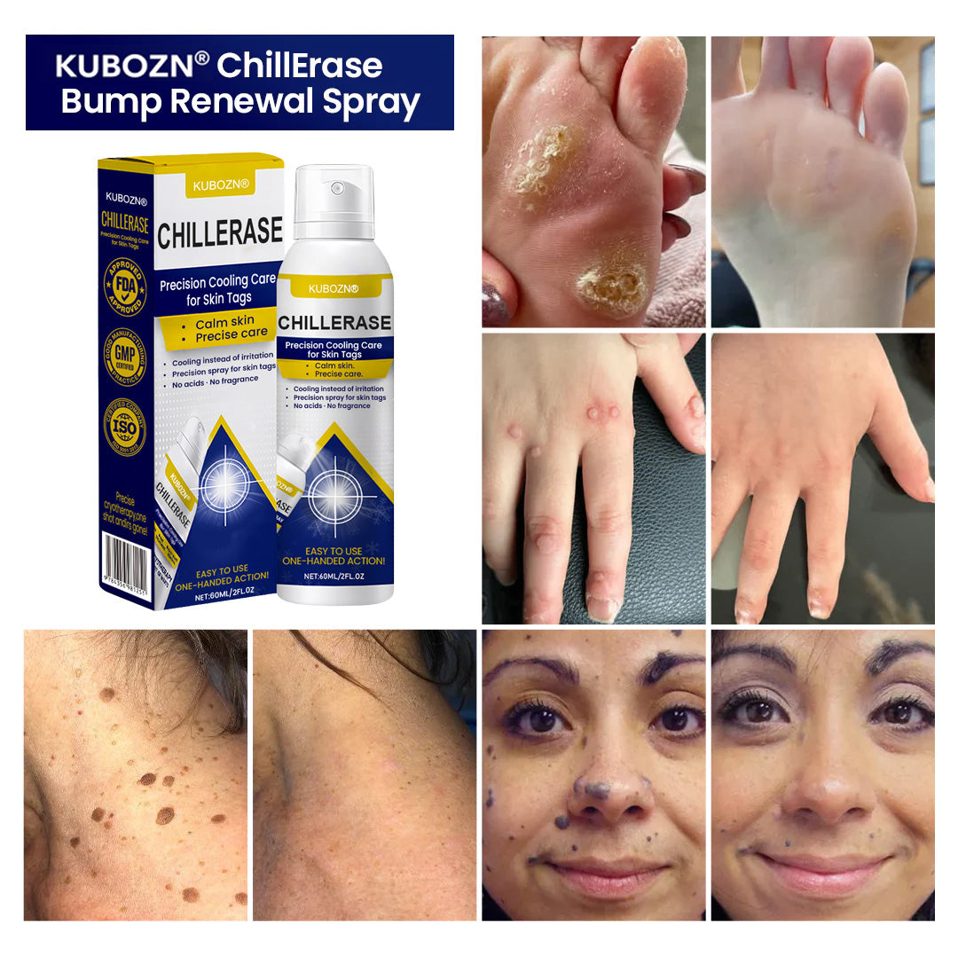 ⚡KUBOZN® ChillErase Cooling Spray for Skin Tags